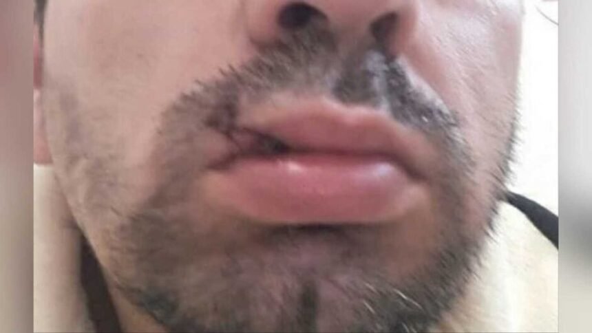 Jovem quebra dois dentes ao apanhar do ex da namorada no Jardim Anache